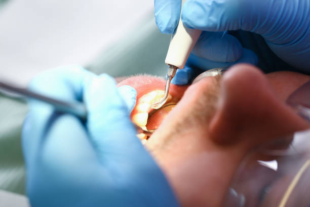 Best Emergency Dental Care for Abscessed Tooth in Wyncote, PA