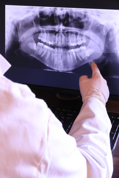 Best Emergency Dentist for Knocked-Out Tooth in Wyncote, PA